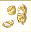 金牙和镶牙图片(image)
